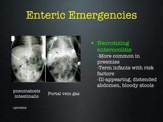 Enteric Emergencies <ul><li>Necrotizing enterocolitis -More common in preemies -Term infants with risk factors  -Ill-appea...