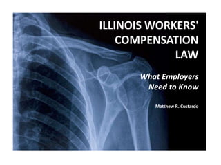 ILLINOIS WORKERS'
COMPENSATION
LAW
What Employers
Need to Know
Matthew R. Custardo
 