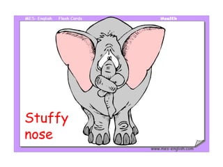 Stuffy 
nose 
 
