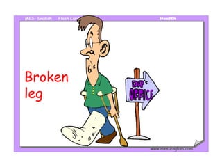 Broken 
leg 
 