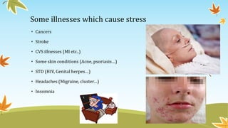 Some illnesses which cause stress 
• Cancers 
• Stroke 
• CVS illnesses (MI etc..) 
• Some skin conditions (Acne, psoriasis…) 
• STD (HIV, Genital herpes…) 
• Headaches (Migraine, cluster…) 
• Insomnia 
 
