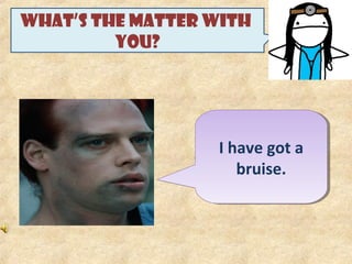 WHAT’S THE MATTER WITH
YOU?
I have got a
bruise.
I have got a
bruise.
 