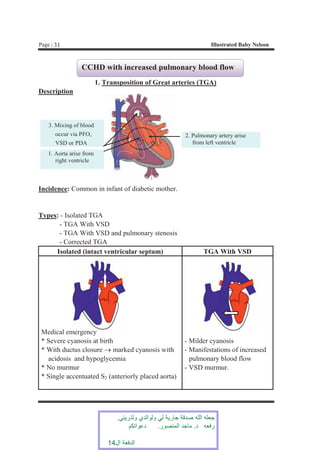 Vsd Incedence illustrated_baby_nelson_specific_and_general.pdf