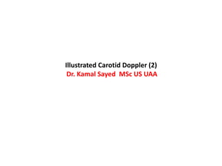 Illustrated Carotid Doppler (2)
Dr. Kamal Sayed MSc US UAA
 