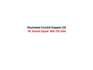 Illustrated Carotid Doppler (3)
Dr. Kamal Sayed MSc US UAA
 