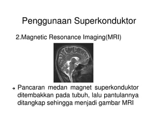 Penggunaan Superkonduktor
2.Magnetic Resonance Imaging(MRI)
Pancaran medan magnet superkonduktor
ditembakkan pada tubuh, lalu pantulannya
ditangkap sehingga menjadi gambar MRI
 