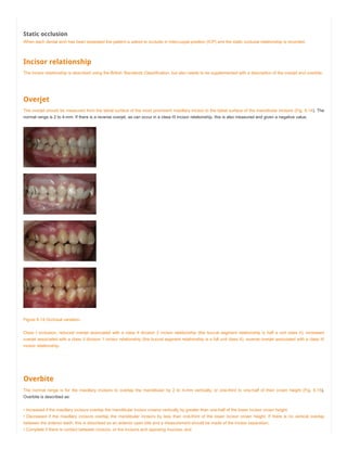 Static occlusion
When each dental arch has been assessed the patient is asked to occlude in intercuspal position (ICP) and the static occlusal relationship is recorded.
Incisor relationship
The incisor relationship is described using the British Standards Classification, but also needs to be supplemented with a description of the overjet and overbite.
Overjet
The overjet should be measured from the labial surface of the most prominent maxillary incisor to the labial surface of the mandibular incisors (Fig. 6.14). The
normal range is 2 to 4-mm. If there is a reverse overjet, as can occur in a class III incisor relationship, this is also measured and given a negative value.
Figure 6.14 Occlusal variation.
Class I occlusion; reduced overjet associated with a class II division 2 incisor relationship (the buccal segment relationship is half a unit class II); increased
overjet associated with a class II division 1 incisor relationship (the buccal segment relationship is a full unit class II); reverse overjet associated with a class III
incisor relationship.
Overbite
The normal range is for the maxillary incisors to overlap the mandibular by 2 to 4-mm vertically, or one-third to one-half of their crown height (Fig. 6.15).
Overbite is described as:
• Increased if the maxillary incisors overlap the mandibular incisor crowns vertically by greater than one-half of the lower incisor crown height;
• Decreased if the maxillary incisors overlap the mandibular incisors by less than one-third of the lower incisor crown height. If there is no vertical overlap
between the anterior teeth, this is described as an anterior open bite and a measurement should be made of the incisor separation;
• Complete if there is contact between incisors, or the incisors and opposing mucosa; and
 
