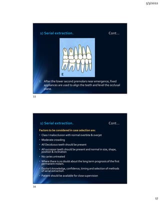 5/3/2022
17
1) Serial extraction. Cont…
E. After the lower second premolars near emergence, fixed
appliances are used to align the teeth and level the occlusal
plane.
E. After the lower second premolars near emergence, fixed
appliances are used to align the teeth and level the occlusal
plane.
E
1) Serial extraction. Cont…
Factors to be considered in case selection are:
• Class I malocclusion with normal overbite  overjet
• Moderate crowding
• All Deciduous teeth should be present
• All successor teeth should be present and normal in size, shape,
position  inclination
• No caries untreated
• Where there is no doubt about the long term prognosis of the first
permanent molars.
• Doctor’s knowledge, confidence, timing and selection of methods
of serial extraction.
• Patient should be available for close supervision
Factors to be considered in case selection are:
• Class I malocclusion with normal overbite  overjet
• Moderate crowding
• All Deciduous teeth should be present
• All successor teeth should be present and normal in size, shape,
position  inclination
• No caries untreated
• Where there is no doubt about the long term prognosis of the first
permanent molars.
• Doctor’s knowledge, confidence, timing and selection of methods
of serial extraction.
• Patient should be available for close supervision
33
34
 