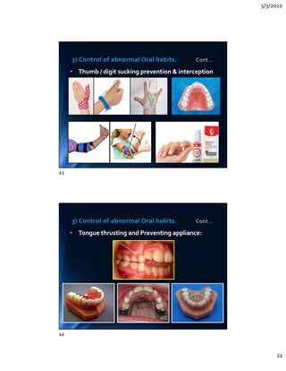 5/3/2022
22
3) Control of abnormal Oral habits. Cont…
• Thumb / digit sucking prevention  interception
• Thumb / digit sucking prevention  interception
3) Control of abnormal Oral habits. Cont…
• Tongue thrusting and Preventing appliance:
• Tongue thrusting and Preventing appliance:
43
44
 