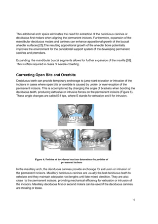 5
This additional arch space eliminates the need for extraction of the deciduous canines or
deciduous first molars when aligning the permanent incisors. Furthermore, expansion of the
mandibular deciduous molars and canines can enhance appositional growth of the buccal
alveolar surfaces [25].The resulting appositional growth of the alveolar bone potentially
improves the environment for the periodontal support system of the developing permanent
canines and premolars.
Expanding the mandibular buccal segments allows for further expansion of the maxilla [26].
This is often required in cases of severe crowding.
Correcting Open Bite and Overbite
Deciduous teeth can provide temporary anchorage to jump-start extrusion or intrusion of the
incisors in cases where open bite or overbite is caused by under- or over-eruption of the
permanent incisors. This is accomplished by changing the angle of brackets when bonding the
deciduous teeth, producing extrusive or intrusive forces on the permanent incisors (Figure 6).
These angle changes are called E-I tips, where E stands for extrusion and I for intrusion.
In the maxillary arch, the deciduous canines provide anchorage for extrusion or intrusion of
the permanent incisors. Maxillary deciduous canines are usually the last deciduous teeth to
exfoliate and they maintain adequate root lengths until late mixed dentition. They are also
close to the permanent incisors, providing mechanical efficiency for extrusion or intrusion of
the incisors. Maxillary deciduous first or second molars can be used if the deciduous canines
are missing or loose.
Figure 6. Position of deciduous brackets determines the position of
permanent incisors
 