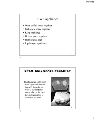 5/3/2022
5
Fixed appliance
• Open coiled space regainer
• Jackscrew space regainer
• King appliance
• Gerber space regainer
• Hotz lingual arch
• Lip bumper appliance
9
OPEN COIL SPACE REGAINER
- Band adapted on to tooth
 an open coil inserted
into a U shaped wire.
Wire is inserted into
molar tube on the band
 whole assembly is
cemented on tooth
10
9
10
 