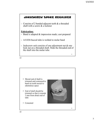 5/3/2022
7
JACKSCREW SPACE REGAINER
- Consists of 2 banded adjacent teeth  a threaded
shaft with a screw  a locknut
Fabrication:
- Band is adapted  impression made; cast prepared
- A 0.036 buccal tube is welded to molar band
- Jackscrew unit consists of one adjustment nut  one
lock nut on a threaded shaft. Slide the threaded end of
the shaft into the molar tube
13
• Mesial end of shaft is
trimmed and contoured to
band on tooth mesial to
edentulous space
• End of shaft should be
trimmed so that it extends
2 mm from distal end of
tube
• Cemented
14
13
14
 