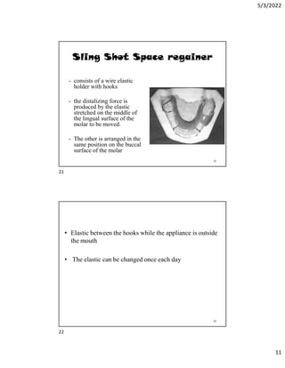 5/3/2022
11
Sling Shot Space regainer
- consists of a wire elastic
holder with hooks
- the distalizing force is
produced by the elastic
stretched on the middle of
the lingual surface of the
molar to be moved.
- The other is arranged in the
same position on the buccal
surface of the molar
21
• Elastic between the hooks while the appliance is outside
the mouth
• The elastic can be changed once each day
22
21
22
 