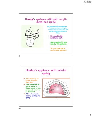 5/3/2022
5
Hawley’s appliance with split acrylic
dumb-bell spring
The spring should be adjusted
twice a month, creating an
increment of opening in a split
acrylic area of 0.5mm at a
time.
It is used in the
mandibular arch.
Space regained is upto
2mm by this appliance.
It is an effective 
comfortable appliance.
Hawley’s appliance with palatal
spring
It is made up of
0.5mm stainless
steel wire.
The active arm of
palatal spring is
placed mesial to the
permanent molar to
be distalized.
The activation is
2mm by opening the
spring.
9
10
 