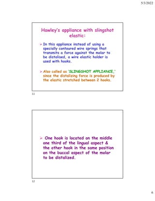 5/3/2022
6
Hawley’s appliance with slingshot
elastic:
 In this appliance instead of using a
specially contoured wire springs that
transmits a force against the molar to
be distalised, a wire elastic holder is
used with hooks.
 Also called as ‘SLINGSHOT APPLIANCE,’
since the distalizing force is produced by
the elastic stretched between 2 hooks.
 One hook is located on the middle
one third of the lingual aspect 
the other hook in the same position
on the buccal aspect of the molar
to be distalized.
11
12
 