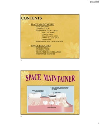 4/23/2022
2
CONTENTS
• SPACE MAINTAINER
• INTRODUCTION
• CLASSIFICATION
• FIXED SPACE MAINTAINER
» BAND AND LOOP
» LINGUAL ARCH
» TRANSPALATAL ARCH
» NANCE PALATAL ARCH
» DISTAL SHOE
• REMOVABLE SPACE MAINTAINER
• SPACE REGAINER
• INTRODUCTION
• CLASSIFICATION
• REMOVABLE SPACE REGAINER
• FIXED SPACE REGAINER
3
4
 