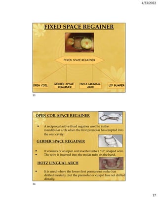 4/23/2022
17
FIXED SPACE REGAINER
HOTZ LINGUAL
ARCH
LIP BUMPER
GERBER SPACE
REGAINER
OPEN COIL
FIXED SPACE REGAINER
OPEN COIL SPACE REGAINER
• A reciprocal active fixed regainer used to in the
mandibular arch when the first premolar has erupted into
the oral cavity.
• It consists of an open coil inserted into a “U” shaped wire.
• The wire is inserted into the molar tube on the band.
GERBER SPACE REGAINER
• It is used where the lower first permanent molar has
drifted mesially ,but the premolar or cuspid has not drifted
distally.
HOTZ LINGUAL ARCH
33
34
 