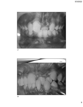 5/3/2022
9
Free template from
www.brainybetty.com
17
5/3/2022
Free template from
www.brainybetty.com
18
5/3/2022
17
18
 