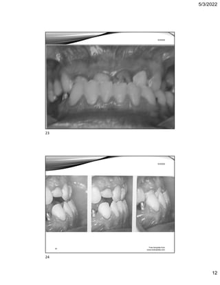 5/3/2022
12
Free template from
www.brainybetty.com
23
5/3/2022
Free template from
www.brainybetty.com
24
5/3/2022
23
24
 