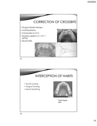 5/3/2022
13
CORRECTION OF CROSSBITE
• Tongue blade therapy
• Inclined planes
• Composite inclines
• Hawleys appliance with Z
spring
• Quad helix
INTERCEPTION OF HABITS
• Thumb sucking
• Tongue thrusting
• Mouth breathing
Fixed tongue
rake
25
26
 