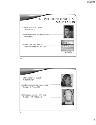 5/3/2022
18
INTERCEPTION OF SKELETAL
MALRELATION
• Interception of class II
malocclusion
Maxillary excess- face bow with
headgear
Mandibular deficiency -
myofunctional appliances
Twin-block
• Interception of class III
malocclusion
Maxillary deficiency - face mask
therapy or Frankel III
Mandibular excess - chin cup
therapy with headgear
35
36
 