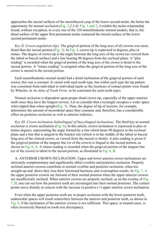 AJO-DO 1972 Sep (296-309): The six keys to normal occlusion - Andrews
approaches the mesial surfaces of the mesiobuccal cusp of the lower second molar, the better the
opportunity for normal occlusion (Fig. 2,2,3,4). Fig. 1 and 2, 4 exhibit the molar relationship
found, without exception, in every one of the 120 nonorthodontic normal models; that is, the
distal surface of the upper first permanent molar contacted the mesial surface of the lower
second permanent molar.
Key II. Crown angulation (tip). The gingival portion of the long axes of all crowns was more
distal than the incisal portion (Fig. 3). In Fig. 4, crown tip is expressed in degrees, plus or
minus. The degree of crown tip is the angle between the long axis of the crown (as viewed from
the labial or buccal surface) and a line bearing 90 degrees from the occlusal plane. A plus
reading is awarded when the gingival portion of the long axis of the crown is distal to the
incisal portion. A minus reading is assigned when the gingival portion of the long axis of the
crown is mesial to the incisal portion.
Each nonorthodontic normal model had a distal inclination of the gingival portion of each
crown; this was a constant. It varied with each tooth type, but within each type the tip pattern
was consistent from individual to individual (quite as the locations of contact points were found
by Wheeler, in An Atlas of Tooth Form, to be consistent for each tooth type).
Normal occlusion is dependent upon proper distal crown tip, especially of the upper anterior
teeth since they have the longest crowns. Let us consider that a rectangle occupies a wider space
when tipped than when upright (Fig. 5). Thus, the degree of tip of incisors, for example,
determines the amount of mesiodistal space they consume and, therefore, has a considerable
effect on posterior occlusion as well as anterior esthetics.
Key III. Crown inclination (labiolingual of buccolingual inclination). The third key to normal
occlusion is crown inclination (Fig. 6). In this article, crown inclination is expressed in plus or
minus degrees, representing the angle formed by a line which bears 90 degrees to the occlusal
plane and a line that is tangent to the bracket site (which is in the middle of the labial or buccal
long axis of the clinical crown, as viewed from the mesial or distal). A plus reading is given if
the gingival portion of the tangent line (or of the crown) is lingual to the incisal portion, as
shown in Fig. 6, A. A minus reading is recorded when the gingival portion of the tangent line
(or of the crown) is labial to the incisal portion, as illustrated in Fig. 6, B.
A. ANTERIOR CROWN INCLINATION. Upper and lower anterior crown inclinations are
intricately complementary and significantly affect overbite and posterior occlusion. Properly
inclined anterior crowns contribute to normal overbite and posterior occlusion, when too
straight-up and -down they lose their functional harmony and overeruption results. In Fig. 7, A
the upper posterior crowns are forward of their normal position when the upper anterior crowns
are insufficiently inclined. When anterior crowns are properly inclined, as on the overlay of Fig.
7, B, one can see how the posterior teeth are encouraged into their normal positions. The contact
points move distally in concert with the increase in positive (+) upper anterior crown inclination.
Even when the upper posterior teeth are in proper occlusion with the lower posterior teeth,
undesirable spaces will result somewhere between the anterior and posterior teeth, as shown in
Fig. 8, if the inclination of the anterior crowns is not sufficient. This space, in treated cases, is
often incorrectly blamed on tooth size discrepancy.
Article Text 4
 