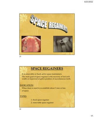 4/23/2022
15
SPACE REGAINERS
• It is removable or fixed, active space maintainers.
• The main goal of space regainer is the recovery of lost arch
width or improved eruptive position of succedaneous teeth.
INDICATION
• When there is need to re-establish about 3 mm or less
of space.
TYPES
1. fixed space regainer
2. removable space regainer
29
30
 