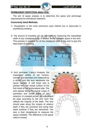 5th
Year Lec. No. 12 ‫الحويزي‬ ‫فيصل‬ ‫أكرم‬ .‫د‬ .‫أ‬
4
PERMANENT DENTITION ANALYSIS:
The aim of space analysis is to determine the space and anchorage
requirements for orthodontic treatment.
Commonly Used Methods
1- Visualization is the most commonly used method but is inaccurate in
quantifying crowding.
2- The amount of crowding can be calculated by measuring the mesiodistal
width of any misaligned tooth in relation to the available space in the arch.
This process is repeated for all the misaligned teeth in the arch to give the
total extent of crowding.
3- Arch perimeter/ Carey’s Analysis: the
mesiodistal widths of the incisors,
canines and premolars are measured by
a divider and the sum represents the
space needed. A soft brass wire is
passed from the mesial surface of the
first molar to the contra-lateral side. The
wire passes along the buccal cusps of
premolars and incisal edges of the
anteriors. In crowded arches, the wire should
be pass according to the arch form that
reflects the majority of the teeth. The wire
should pass along the cingula of anterior
teeth if they are proclined and along their
labial surfaces if they are retroclined. The
wire is then straightened to measure the
space available. The difference is the space
need or excess.
 