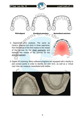 5th
Year Lec. No. 12 ‫الحويزي‬ ‫فيصل‬ ‫أكرم‬ .‫د‬ .‫أ‬
5
4- Segmental arch analysis: The same as
Carey’s Analysis but done in three segments;
from the mesial of the first molars to the mesial
of the canines for the distal segments and
between the mesial of the canines for the
anterior segment.
5- Digital 3D scanning: Many software programs are equipped with a facility to
plot contact points in order to identify the arch form, as well as a ‘virtual
ruler’ that can measure mesiodistal tooth widths.
 
