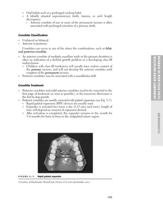133
■ Oral habits such as a prolonged sucking habit.
■ A labially situated supernumerary tooth, trauma, or arch length
discrepancy.
■ Anterior crossbite of one or more of the permanent incisors is often
associated with prolonged retention of a primary tooth.
Crossbite Classiﬁcation
■ Unilateral or bilateral.
■ Anterior or posterior.
Crossbites can occur in any of the above the combinations, such as bilat-
eral posterior crossbite.
■ An anterior crossbite of multiple maxillary teeth in the primary dentition is
often an indication of a skeletal growth problem or a developing class III
malocclusion.
■ Children with class III tendencies will usually have end-on contact of
the primary incisors, and will not develop the anterior crossbite until
eruption of the permanent incisors.
■ Posterior crossbites may be associated with a mandibular shift.
Crossbite Treatment
■ Posterior crossbites and mild anterior crossbites need to be corrected in the
ﬁrst stage of treatment (as soon as possible), as the transverse dimension is
the ﬁrst to stop growth.
■ Posterior crossbites are usually corrected with palatal expansion (see Fig. 5–7):
■ Rapid palatal expansion (RPE) devices are usually used.
■ Expander is activated two times a day (0.25 mm each turn); length of
time will depend on amount of expansion desired.
■ After activation is completed, the expander remains in the mouth for
3–6 months for bone to form in the midpalatal suture region.
DATABASE
OF
H
IG
H-YI
E
LD
FACTS:
DISC
I
PLI
N
E-BASE
D
COM
PON
E
NT
ORTHODONTICS
F I G U R E 5 – 7 . Rapid palatal expander.
(Courtesy of Dockstader Dental Lab, Fresno, CA, www.dockstader.com.)
 
