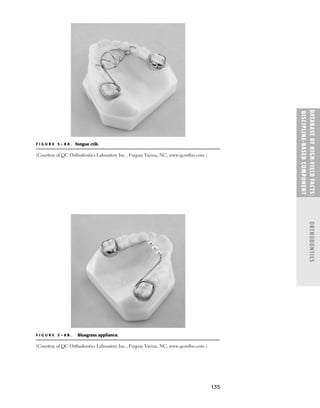 135
DATABASE
OF
H
IG
H-YI
E
LD
FACTS:
DISC
I
PLI
N
E-BASE
D
COM
PON
E
NT
ORTHODONTICS
F I G U R E 5 – 8 A . Tongue crib.
(Courtesy of QC Orthodontics Laboratory Inc., Fuquay Varina, NC, www.qcortho.com.)
F I G U R E 5 – 8 B . Bluegrass appliance.
(Courtesy of QC Orthodontics Laboratory Inc., Fuquay Varina, NC, www.qcortho.com.)
 