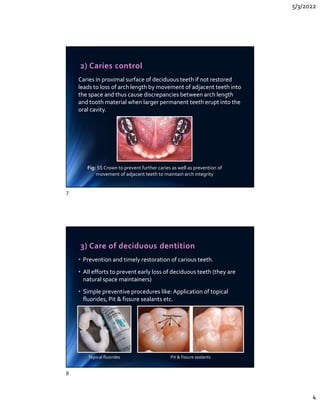 5/3/2022
4
2) Caries control
Caries in proximal surface of deciduous teeth if not restored
leads to loss of arch length by movement of adjacent teeth into
the space and thus cause discrepancies between arch length
and tooth material when larger permanent teeth erupt into the
oral cavity.
Caries in proximal surface of deciduous teeth if not restored
leads to loss of arch length by movement of adjacent teeth into
the space and thus cause discrepancies between arch length
and tooth material when larger permanent teeth erupt into the
oral cavity.
Fig: SS Crown to prevent further caries as well as prevention of
movement of adjacent teeth to maintain arch integrity
3) Care of deciduous dentition
• Prevention and timely restoration of carious teeth.
• All efforts to prevent early loss of deciduous teeth (they are
natural space maintainers)
• Simple preventive procedures like: Application of topical
fluorides, Pit  fissure sealants etc.
• Prevention and timely restoration of carious teeth.
• All efforts to prevent early loss of deciduous teeth (they are
natural space maintainers)
• Simple preventive procedures like: Application of topical
fluorides, Pit  fissure sealants etc.
Topical fluorides Pit  fissure sealants
7
8
 