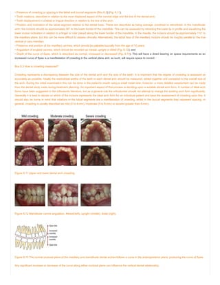• Presence of crowding or spacing in the labial and buccal segments (Box 6.3) (Fig. 6.11);
• Tooth rotations, described in relation to the most displaced aspect of the coronal edge and the line of the dental arch;
• Tooth displacement in a labial or lingual direction in relation to the line of the arch;
• Position and inclination of the labial segment relative to the dental base. These are described as being average, proclined or retroclined. In the mandibular
arch, the incisors should be approximately 90° to the lower border of the mandible. This can be assessed by retracting the lower lip in profile and visualizing the
lower incisor inclination in relation to a finger or ruler placed along the lower border of the mandible. In the maxilla, the incisors should be approximately 110° to
the maxillary plane, but this can be more difficult to assess clinically. Alternatively, the labial face of the maxillary incisors should be roughly parallel to the true
vertical or zero meridian;
• Presence and position of the maxillary canines, which should be palpable buccally from the age of 10 years;
• Angulation of erupted canines, which should be recorded as mesial, upright or distal (Fig. 6.12); and
• Depth of the curve of Spee, which is described as normal, increased or decreased (Fig. 6.13). This will have a direct bearing on space requirements as an
increased curve of Spee is a manifestation of crowding in the vertical plane and, as such, will require space to correct.
Box 6.3 How is crowding measured?
Crowding represents a discrepancy between the size of the dental arch and the size of the teeth. It is important that the degree of crowding is assessed as
accurately as possible. Ideally the mesiodistal widths of the teeth in each dental arch should be measured, added together and compared to the overall size of
the arch. During the initial examination this can be done in the patient’s mouth using a small metal ruler; however, a more detailed assessment can be made
from the dental study casts during treatment planning. An important aspect of this process is deciding upon a suitable dental arch form. A number of ideal arch
forms have been suggested in the orthodontic literature, but as a general rule the orthodontist should not attempt to change the existing arch form significantly.
Generally it is best to decide on which of the incisors represents the ideal arch form for an individual patient and base the assessment of crowding upon this. It
should also be borne in mind that rotations in the labial segments are a manifestation of crowding, whilst in the buccal segments they represent spacing. In
general, crowding is usually described as mild (0 to 4-mm), moderate (5 to 8-mm) or severe (greater than 9-mm).
Figure 6.11 Upper and lower dental arch crowding.
Figure 6.12 Mandibular canine angulation. Mesial (left); upright (middle); distal (right).
Figure 6.13 The normal occlusal plane of the maxillary and mandibular dental arches follows a curve in the anteroposterior plane, producing the curve of Spee.
Any significant increase or decrease of the curve along either occlusal plane can influence the vertical dental relationship.
 