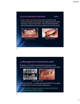 5/3/2022
5
3) Care of deciduous dentition Cont…
• Supernumerary  supplemental teeth can interfere with
eruption of nearby normal teeth.They deflect adjacent teeth
and erupt in abnormal positions. They should be identified
and extracted before they cause displacement of other teeth.
• Supernumerary  supplemental teeth can interfere with
eruption of nearby normal teeth.They deflect adjacent teeth
and erupt in abnormal positions. They should be identified
and extracted before they cause displacement of other teeth.
Supernumerary teeth Supplemental teeth
4) Management of ankylosed tooth
Ankylosis is a condition characterized by absence of the
periodontal ligament in small area or whole of the root surface.
They do not resorb → prevent permanent teeth from erupting
→ deflect them to erupt in abnormal positions.
• They should be removed surgically at appropriate time to
allow emergence of the successor.
Ankylosis is a condition characterized by absence of the
periodontal ligament in small area or whole of the root surface.
They do not resorb → prevent permanent teeth from erupting
→ deflect them to erupt in abnormal positions.
• They should be removed surgically at appropriate time to
allow emergence of the successor.
Fig: Ankylosis of teeth
9
10
 