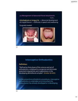 5/3/2022
12
12) Management of abnormal frenal attachments
Cont…
Ankyloglossia or tongue tie → Abnormal development
of Lingual frenum → Difficulty in speech and swallowing
Surgically treated.
Ankyloglossia or tongue tie → Abnormal development
of Lingual frenum → Difficulty in speech and swallowing
Surgically treated.
Interceptive Orthodontics
Definition:
“Defined as that phase of the science and art of
orthodontics, employed to recognize and eliminate
potential irregularities and malpositions in the
developing dentofacial complex. (Graber  AAO)
Unlike preventive orthodontic procedures, interceptive
orthodontics is undertaken at a time when the
malocclusion has already developed or is developing.
Definition:
“Defined as that phase of the science and art of
orthodontics, employed to recognize and eliminate
potential irregularities and malpositions in the
developing dentofacial complex. (Graber  AAO)
Unlike preventive orthodontic procedures, interceptive
orthodontics is undertaken at a time when the
malocclusion has already developed or is developing.
23
24
 