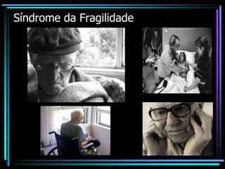 Síndrome da Fragilidade
 