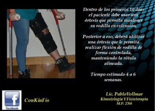 Luxación de Rótula