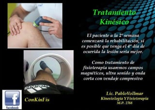 Luxación de Rótula