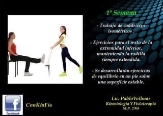 Luxación de Rótula