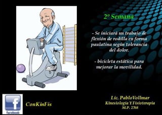 Luxación de Rótula