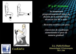 Luxación de Rótula