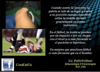 Luxación de Rótula