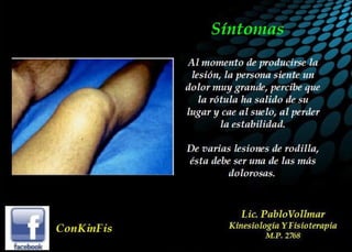 Luxación de Rótula