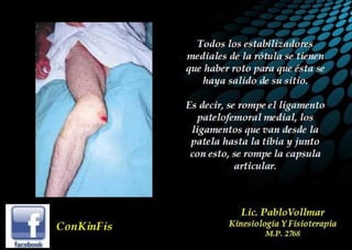 Luxación de Rótula