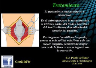 Luxación de Rótula