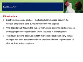 Ultrastructural
 Electron microscopic studies – the first cellular changes occur in the
nucleus of epithelial cells during formation of viral capsids
 Viral capsids bud through the nuclear membrane, acquiring lipid envelopes,
and aggregate into large masses within vacuoles in the cytoplasm
 The cloudy swelling observed in light microscopic studies of early cellular
changes has been associated with the presence of these large masses of
viral particles in the cytoplasm
PATHOLOGY
 
