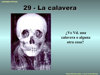 29 - La calavera ¿Ve Vd. una calavera o alguna otra cosa?   