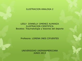 ILUSTRACION ANALOGA 2
LESLY DINNELLY JIMENEZ ALMANZA
ILUSTRACION CIENTIFICA
Bocetos: Traumatología y lesiones del deporte
Profesora: LORENA INES CIFUENTES
UNIVERSIDAD UNIPANAMERICANA
JUNIO 2013
 