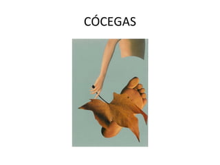 CÓCEGAS 