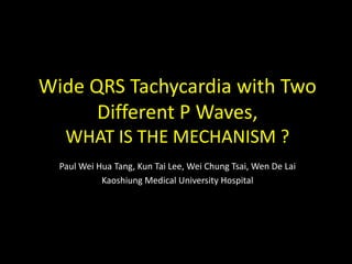 Wide QRS Tachycardia with Two 
      Different P Waves, 
   WHAT IS THE MECHANISM ?
  Paul Wei Hua Tang, Kun Tai Lee, Wei Chung Tsai, Wen De Lai
            Kaoshiung Medical University Hospital
 